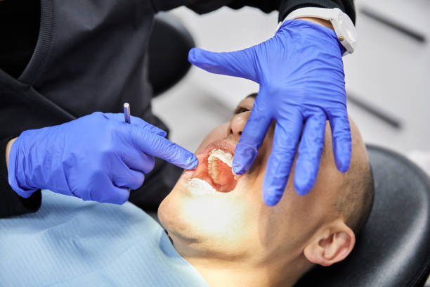 Best Emergency Wisdom Teeth Removal in Bangs, TX